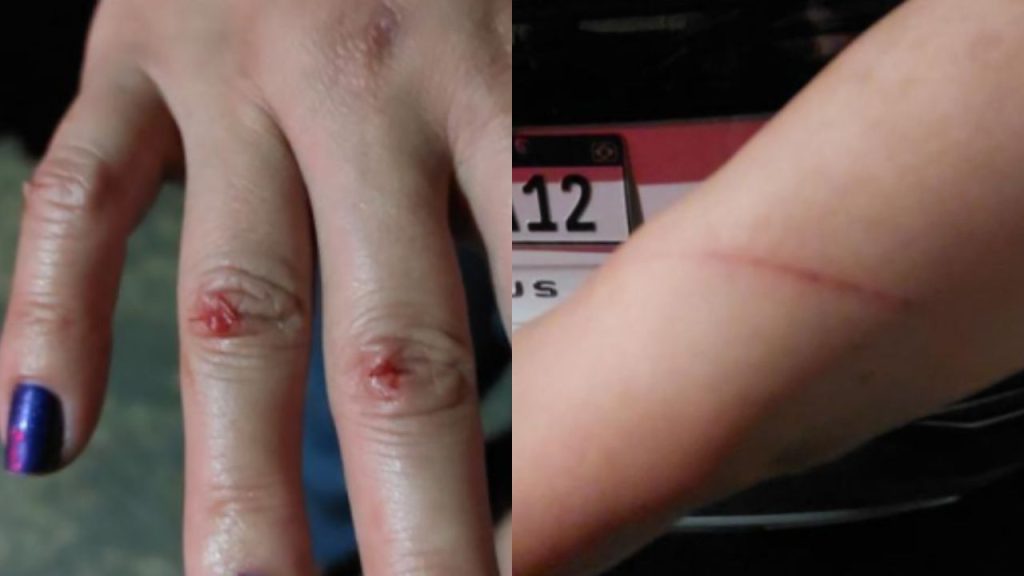 Ferimentos namorada Anápolis carro