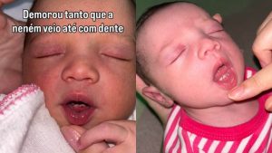 Bebê surpreendeu ao nascer com dentes.