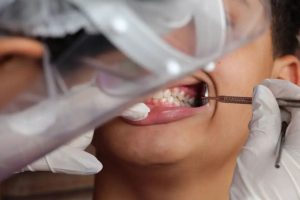 Clínica odontológica é condenada pela Justiça a indenizar paciente por falha em tratamento dentário