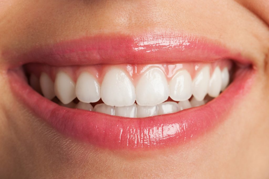 Anvisa determina apreensão e proibição da venda de fita para clareamento dental