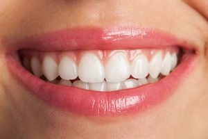 Anvisa determina apreensão e proibição da venda de fita para clareamento dental