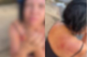 Homem é preso após agredir companheira com faca no Setor Campinas
