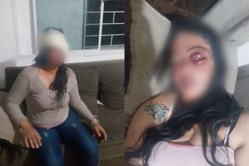 Mulher é brutalmente agredida na frente dos filhos em Anápolis; suspeito fugiu