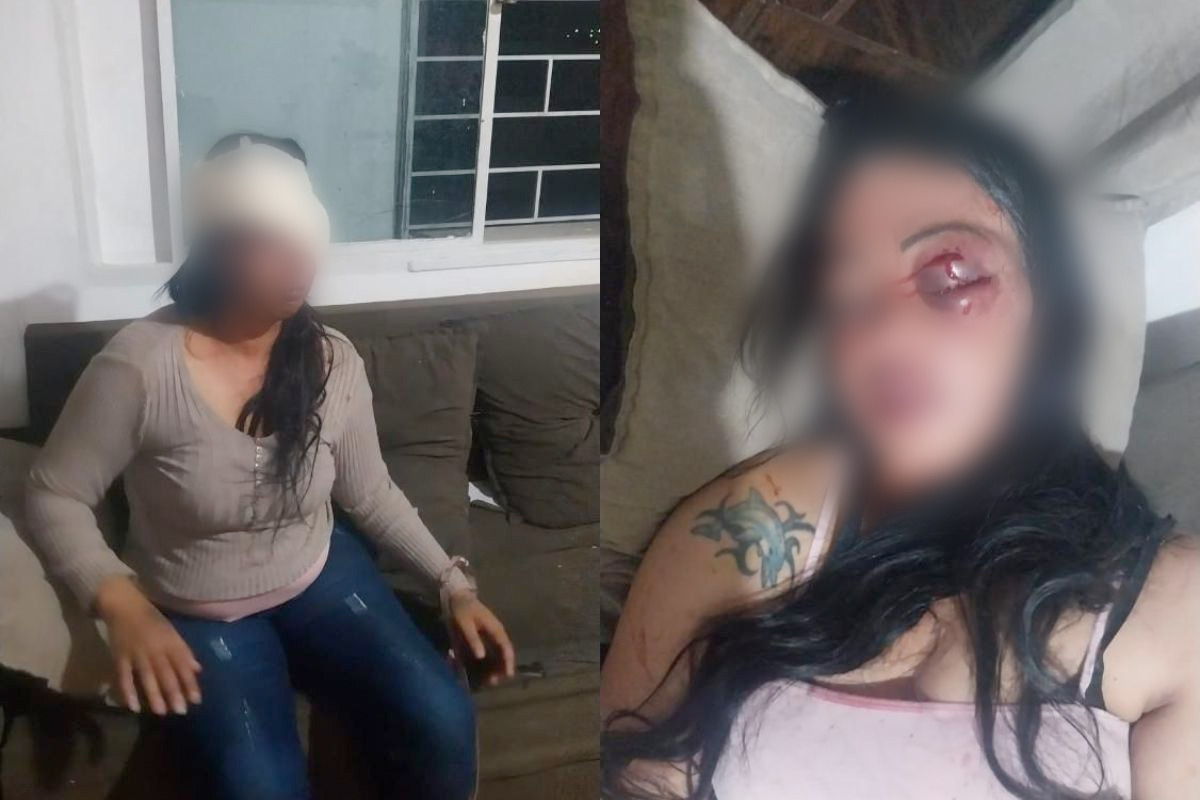 Mulher é brutalmente agredida na frente dos filhos em Anápolis; suspeito fugiu