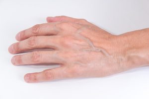 Entenda por que a elite era considerada de “sangue azul”, uma expressão histórica ligada à aristocracia medieval, à pele clara e à distinção social entre classes.