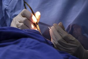 Homem perde testículo após erro em cirurgia de hérnia