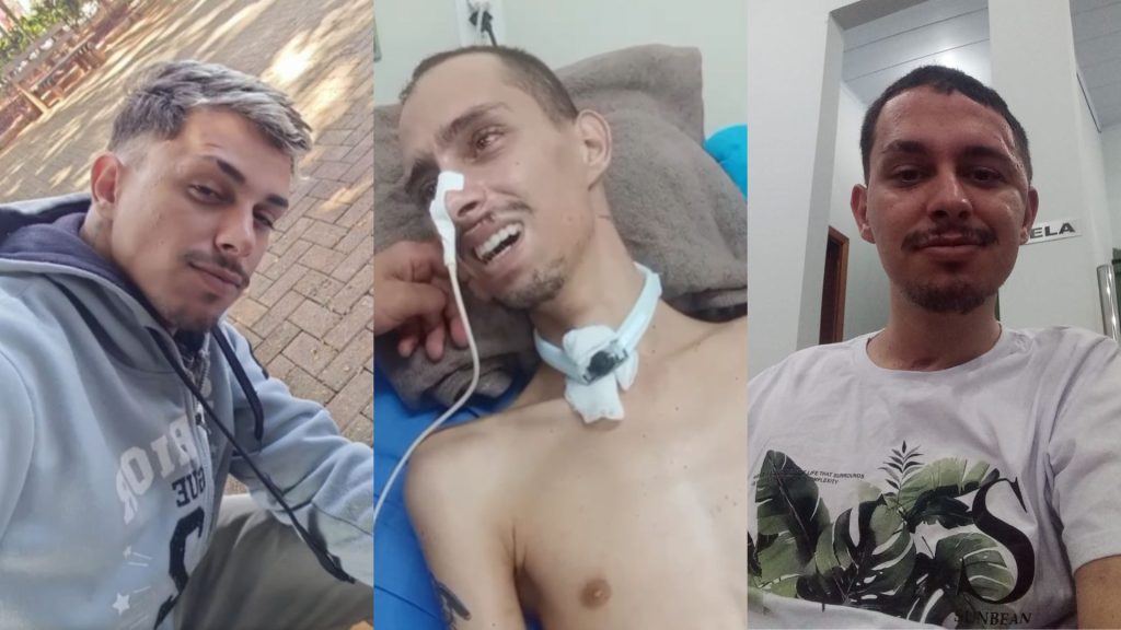 Motoboy Maxsuel Mishainer antes do acidente, durante o tratamento e posteriormente, em casa.