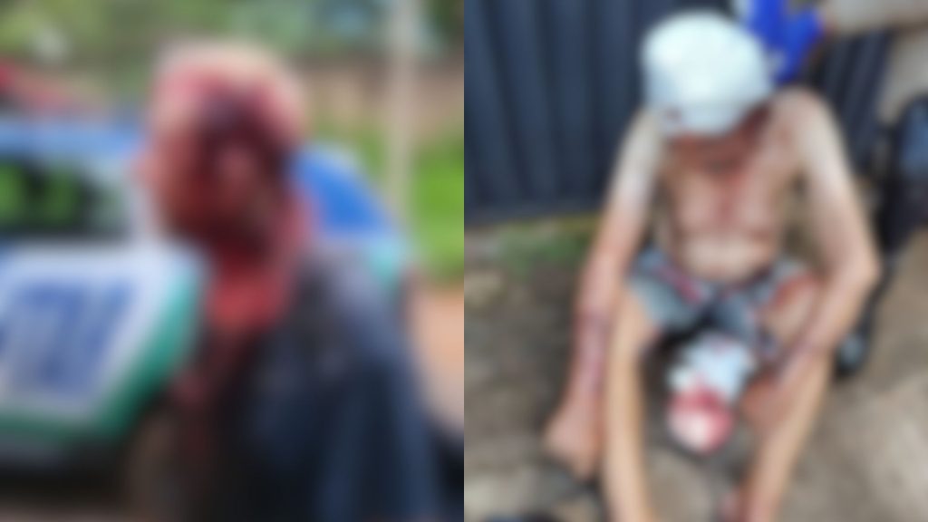 Idoso foi socorrido ensanguentado após as facadas.