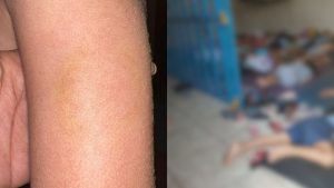 Mãe denuncia que filho foi mordido pela diretora do berçário.