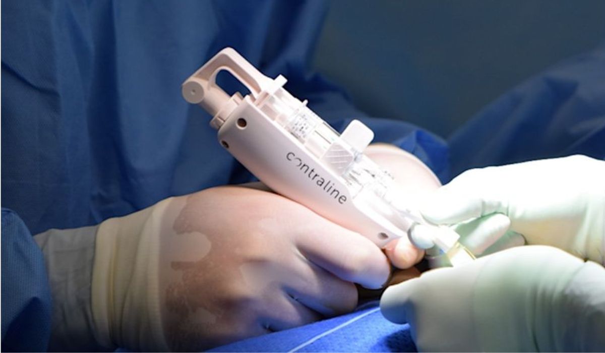 Adeus, vasectomia: anticoncepcional masculino que dura até 2 anos poderá ser comprado na farmácia