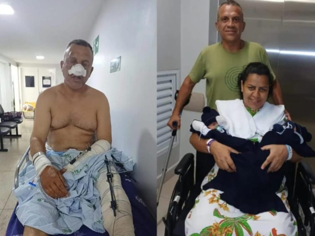 Adriano ainda carrega sequelas do grave acidente sofrido. (Foto: Arquivo Pessoal) motorista