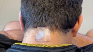 Técnica de colocar cubo de gelo na nuca pode ajudar a aliviar ansiedade ao estimular o nervo vago e desacelerar os batimentos cardíacos.