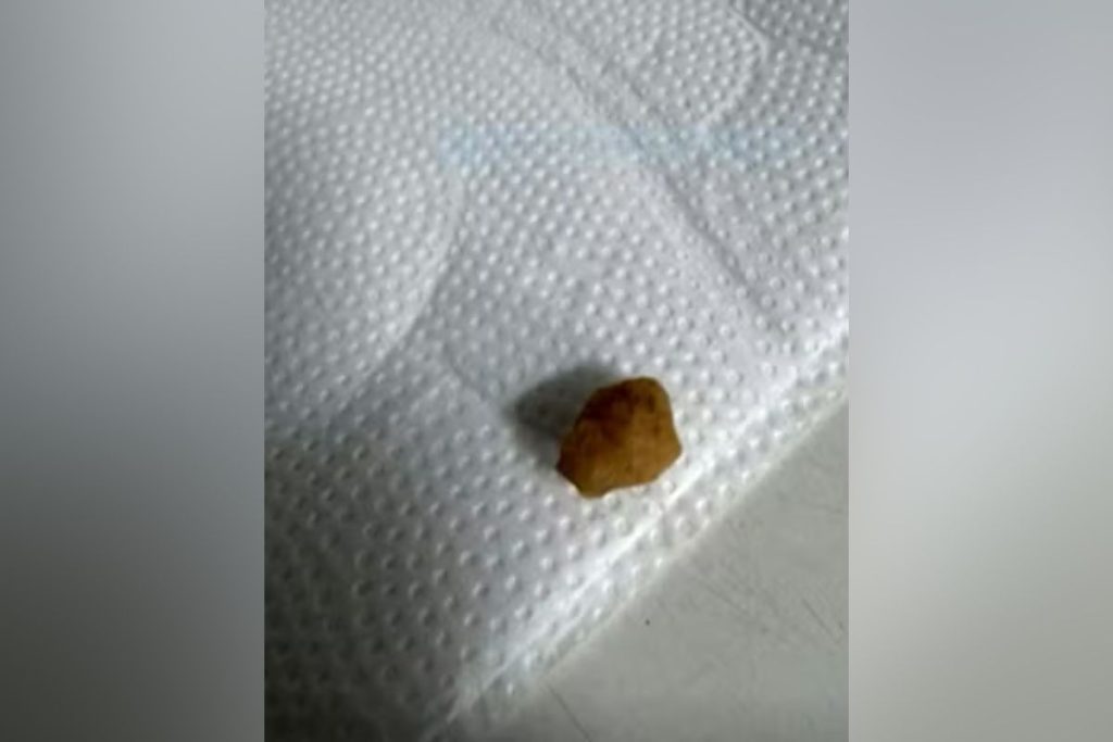 Bebê morre após suspeita de ingestão de pedra de crack em Goianésia