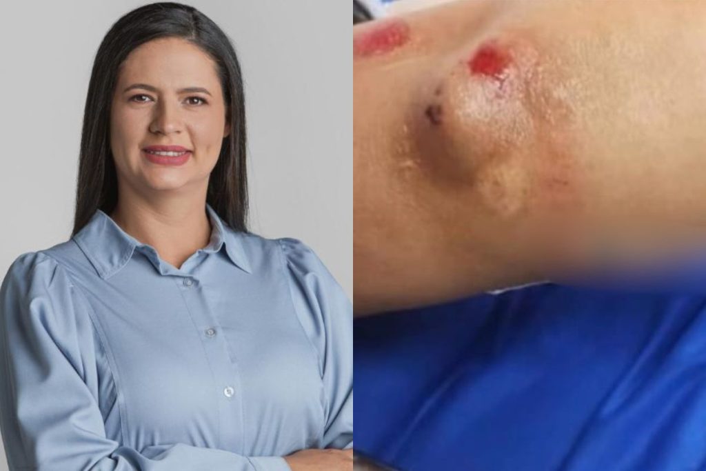 agressão prefeita buritinópolis