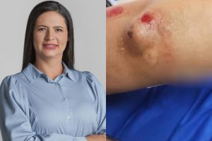 agressão prefeita buritinópolis