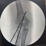 764798-20260327-211752-2d46a1