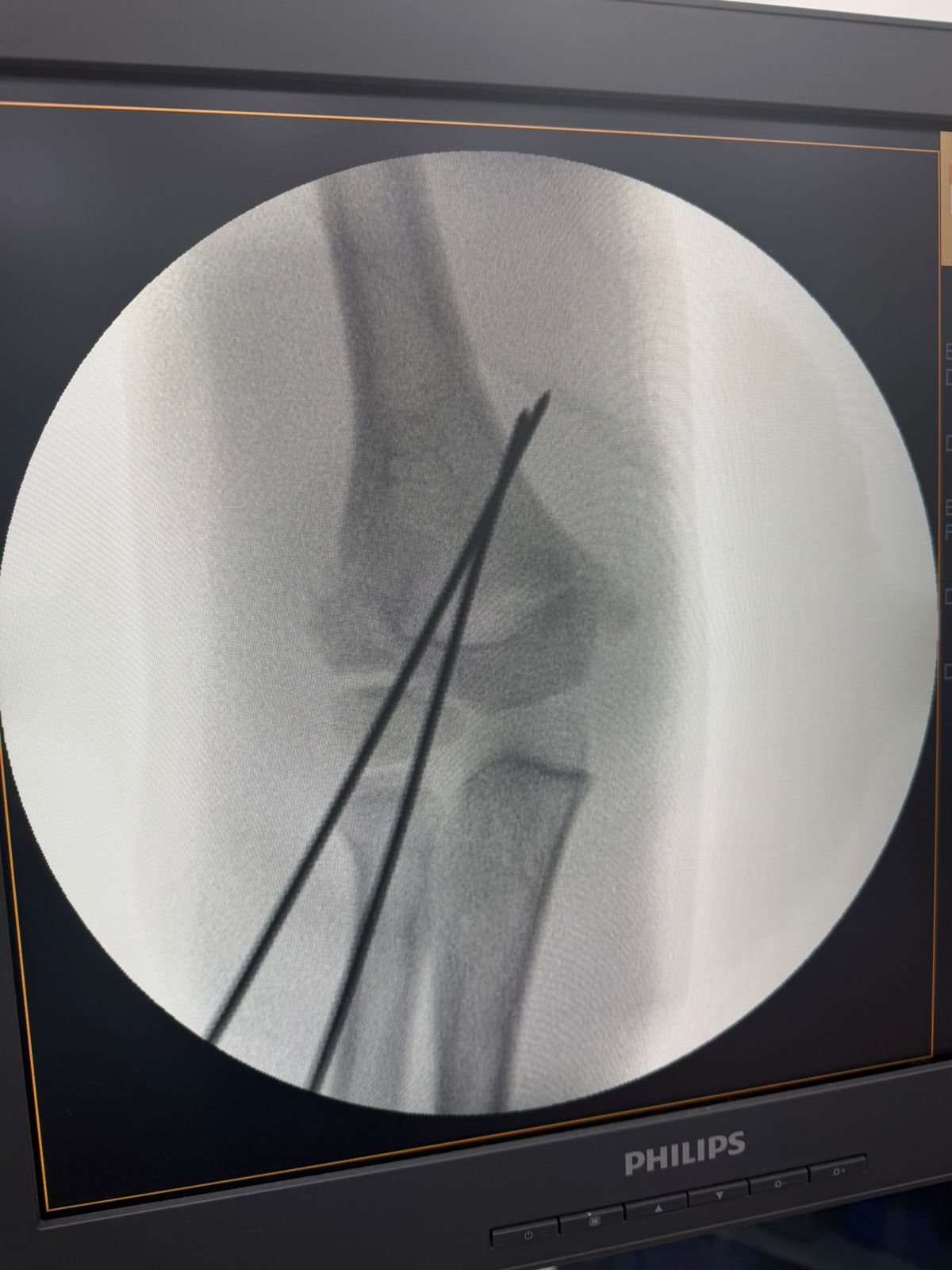 764798-20260327-211752-2d46a1