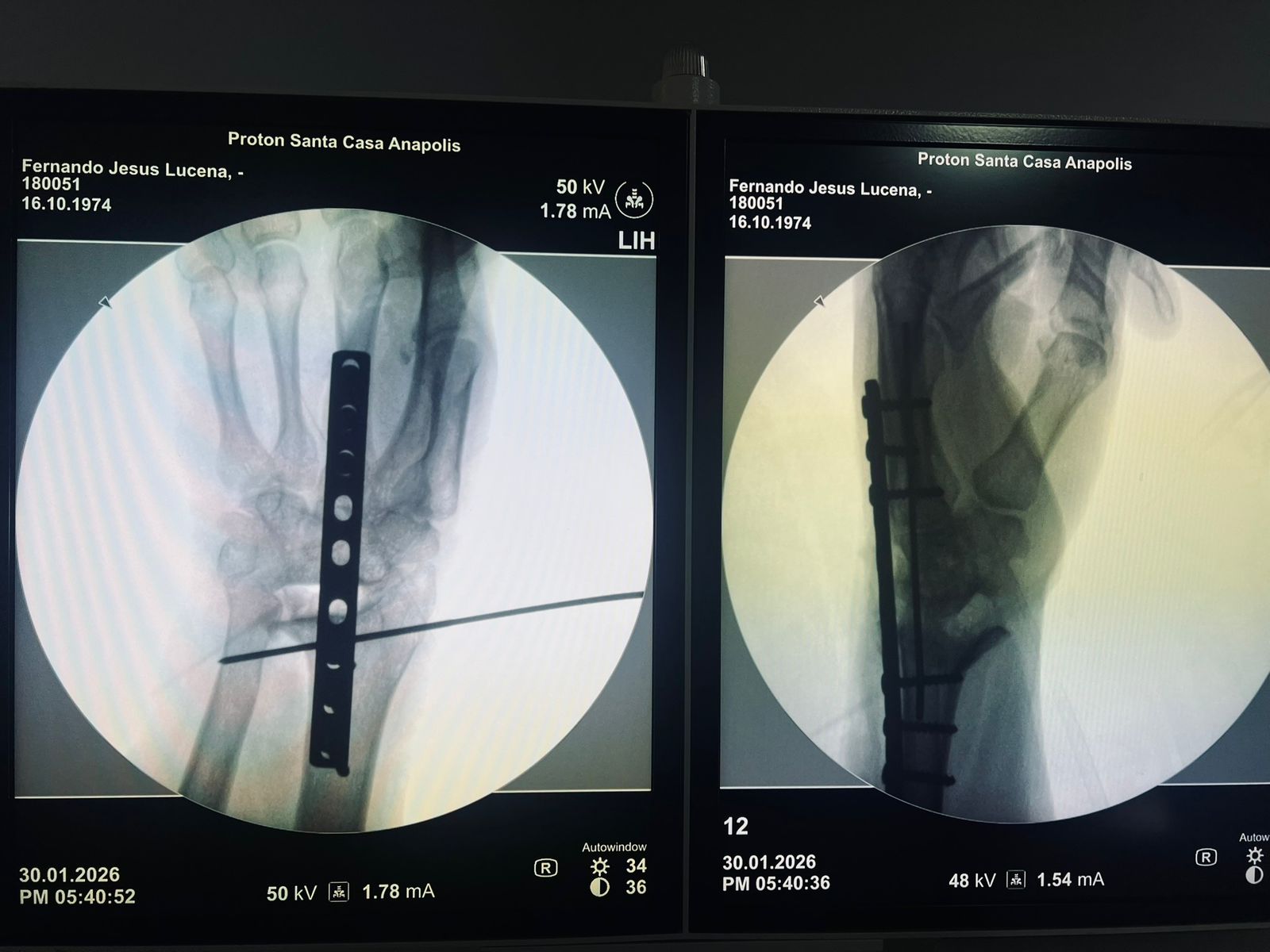 764798-20260327-211754-0df3e9