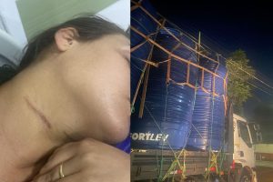 Mulher foi arrastada pelo pescoço após caminhão romper fios de poste, em Anápolis