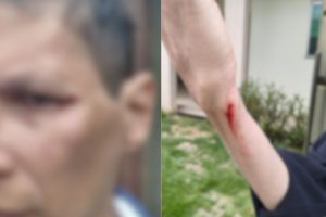 Homem invadiu casa no Anápolis City para agredir e ameaçar de morte a ex-esposa