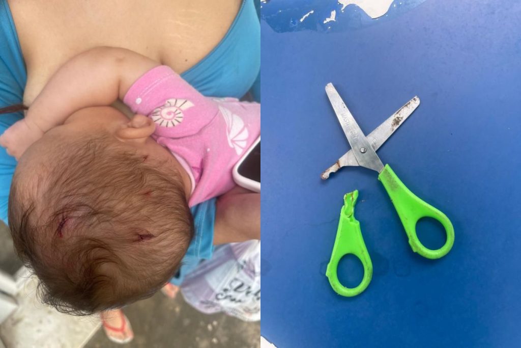 Adolescente tenta matar mãe de sua filha com tesoura e acaba ferindo bebê