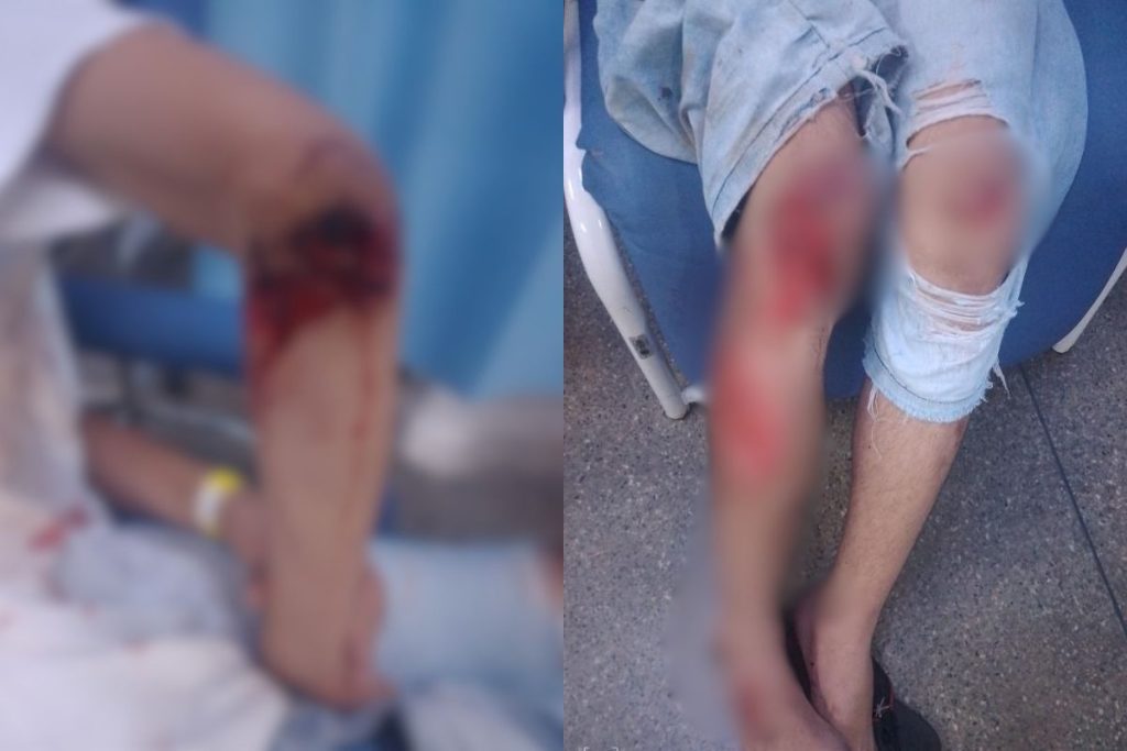 Adolescente empina moto, atropela vigilante e deixa dois feridos durante procissão em Anápolis