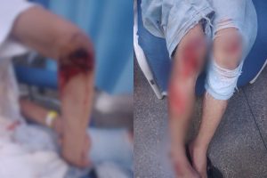 Adolescente empina moto, atropela vigilante e deixa dois feridos durante procissão em Anápolis