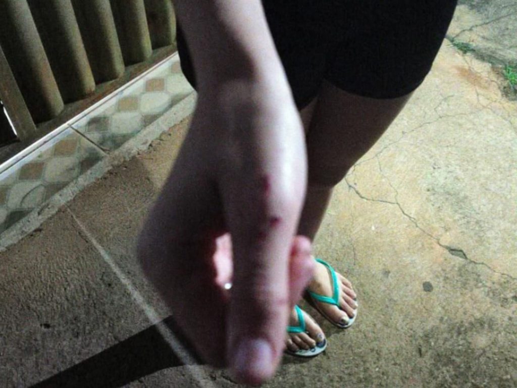 Agressão em Anápolis