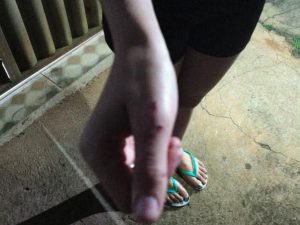 Agressão em Anápolis