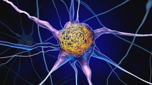 Cientistas identificam vitamina comum que pode reduzir proteínas associadas ao Alzheimer