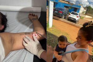 Influenciadora descobre gestação mesmo com método contraceptivo