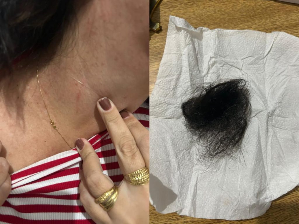 Primeira-dama e adolescente se envolveram em confusão no hospital municipal de Santa Rosa de Goiás. (Foto: Reprodução)