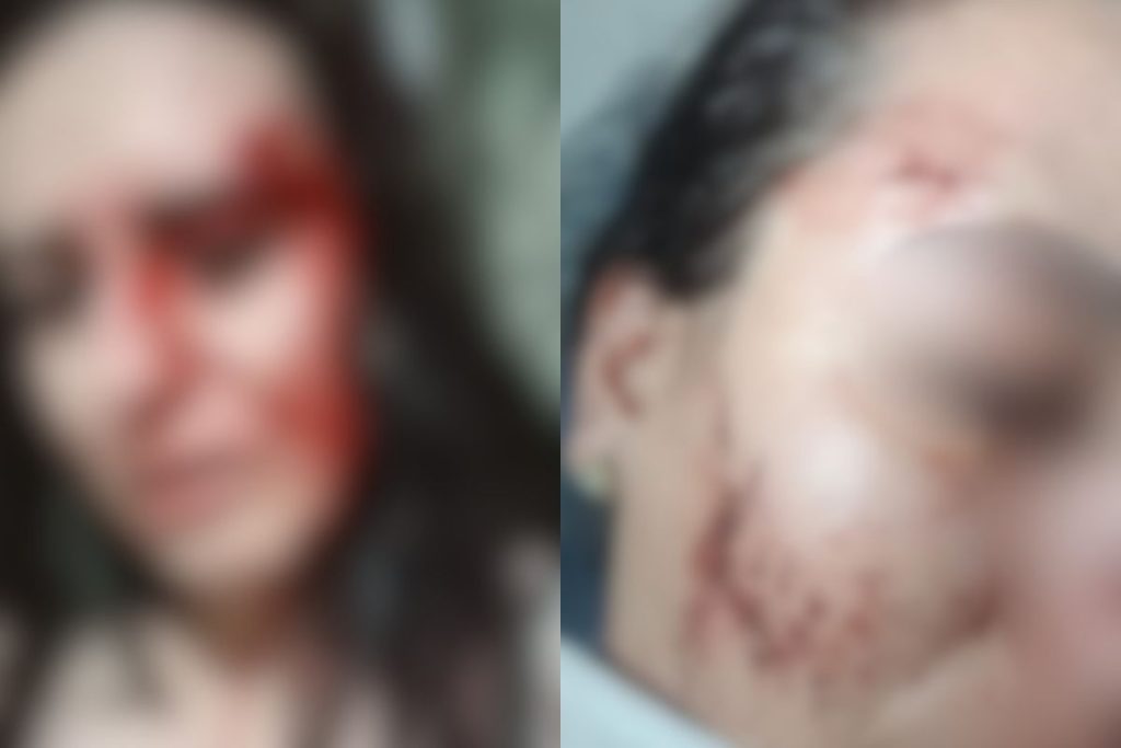 Homem invade casa, agride ex-companheira e foge após ameaças em Anápolis; vítima é levada a hospital