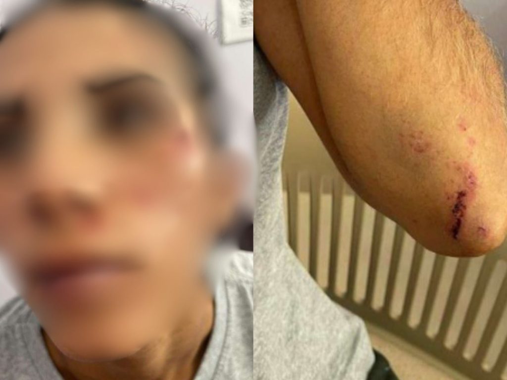 Vítima denunciou ter sido espancada pelo ex. (Foto: Reprodução) vigilante