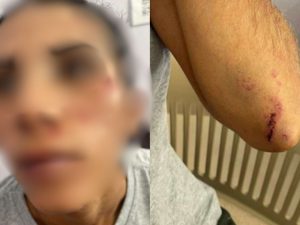 Vítima denunciou ter sido espancada pelo ex. (Foto: Reprodução) vigilante