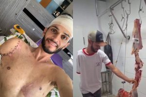 “Eu sabia que seria exemplo para alguém”: açougueiro de Anápolis perdeu braço em acidente e soube reinventar