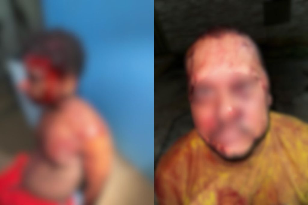 Homem é preso após esfaquear vizinho e adolescente por conta de água em Goiânia