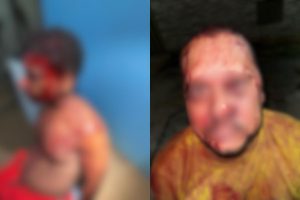 Homem é preso após esfaquear vizinho e adolescente por conta de água em Goiânia