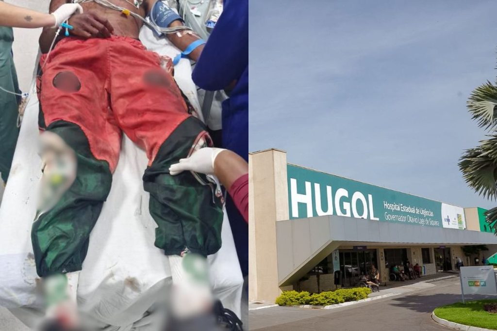 Jovem é levado em estado grave ao Hugol após ataque a tiros em Trindade
