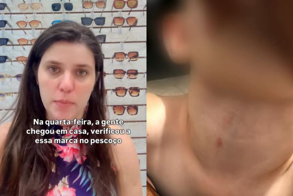 agressão em Cmei