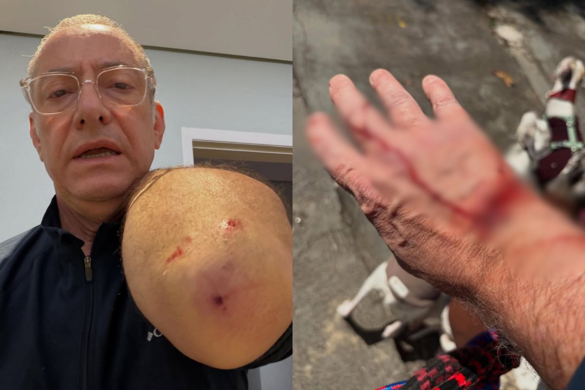 Jornalista da Globo é atacado por pitbull sem guia