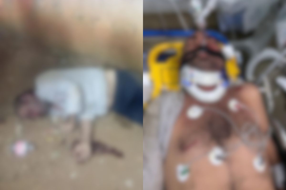 Homem é preso após atacar amigo com pedaço de madeira e deixá-lo em estado grave em Anápolis