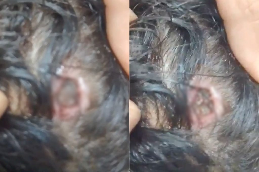 Vídeo gravado por acompanhante mostra criança com grave ferimento na cabeça e denuncia demora no atendimento em unidade de saúde de Anápolis. (Foto: Reprodução)