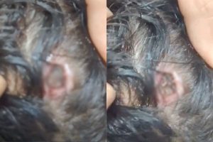Vídeo gravado por acompanhante mostra criança com grave ferimento na cabeça e denuncia demora no atendimento em unidade de saúde de Anápolis. (Foto: Reprodução)