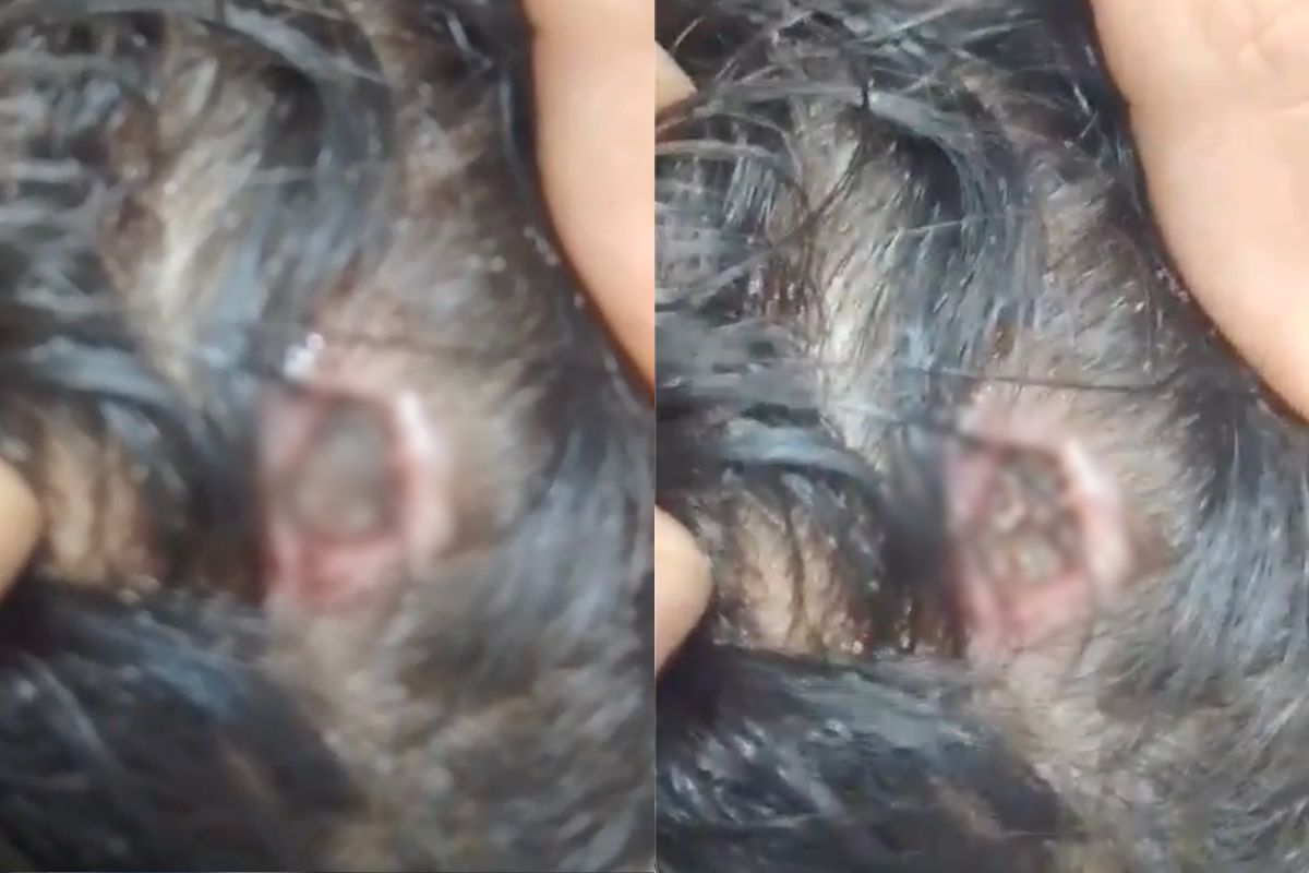 Vídeo gravado por acompanhante mostra criança com grave ferimento na cabeça e denuncia demora no atendimento em unidade de saúde de Anápolis. (Foto: Reprodução)