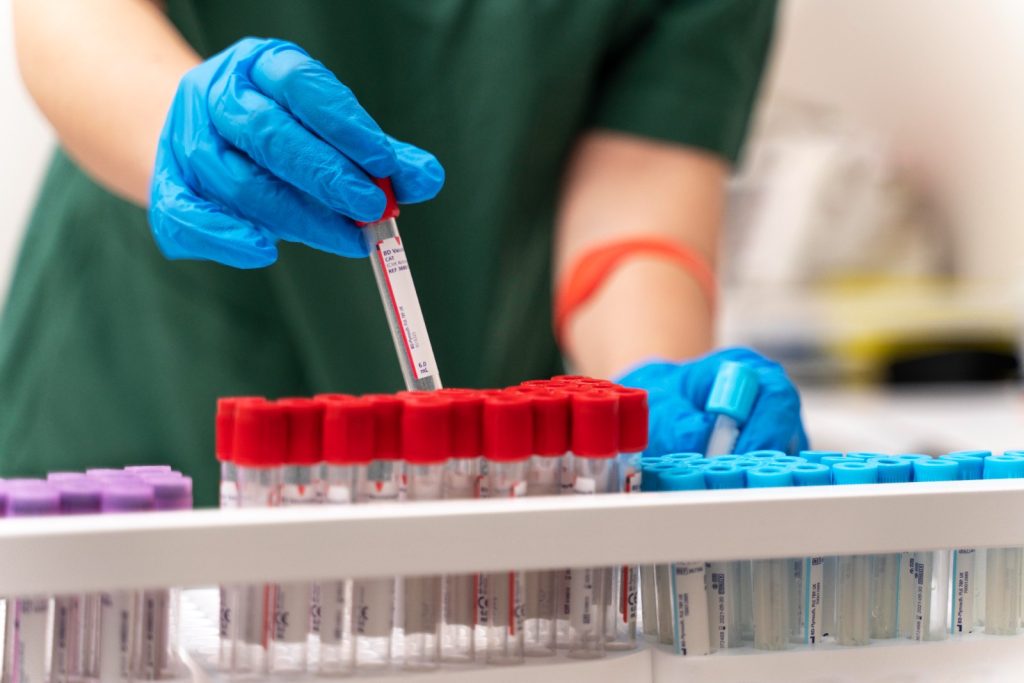 UBSs de Goiânia passam a realizar coleta de exames laboratoriais aos sábados