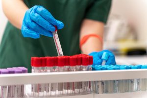 UBSs de Goiânia passam a realizar coleta de exames laboratoriais aos sábados