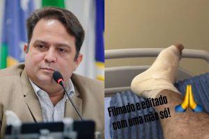 "Depois de três dias internado, as coisas estão melhorando", diz Roberto Naves, que se recupera de acidente