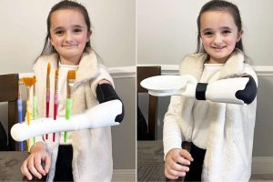 Estudante passa mais de 100 horas em impressora 3D para criar mão multifuncional para irmãzinha de 7 anos: ele adaptou lanterna, pincel e até suporte para cartas de UNO