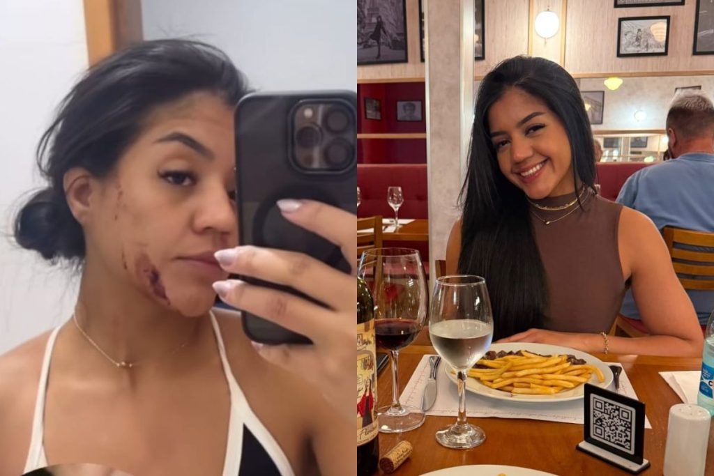 jovem de Anápolis agredida por compenheiro